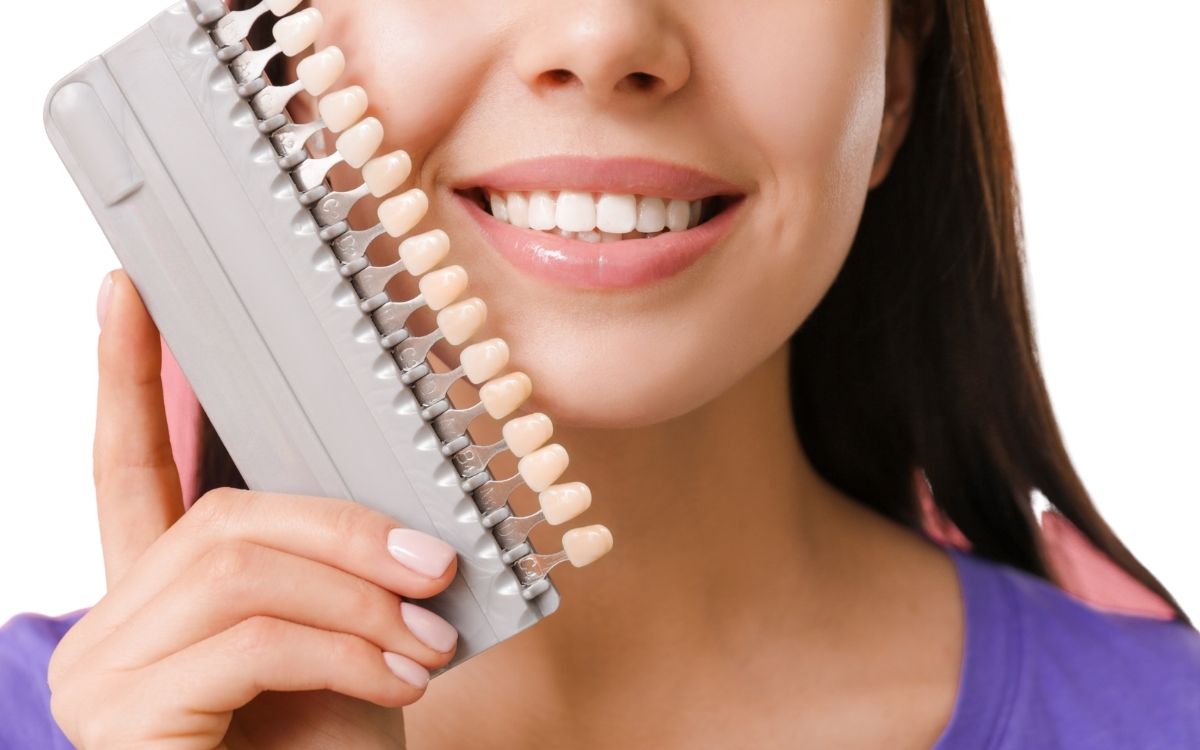 Carillas dentales: ¿Cuáles son sus principales ventajas?